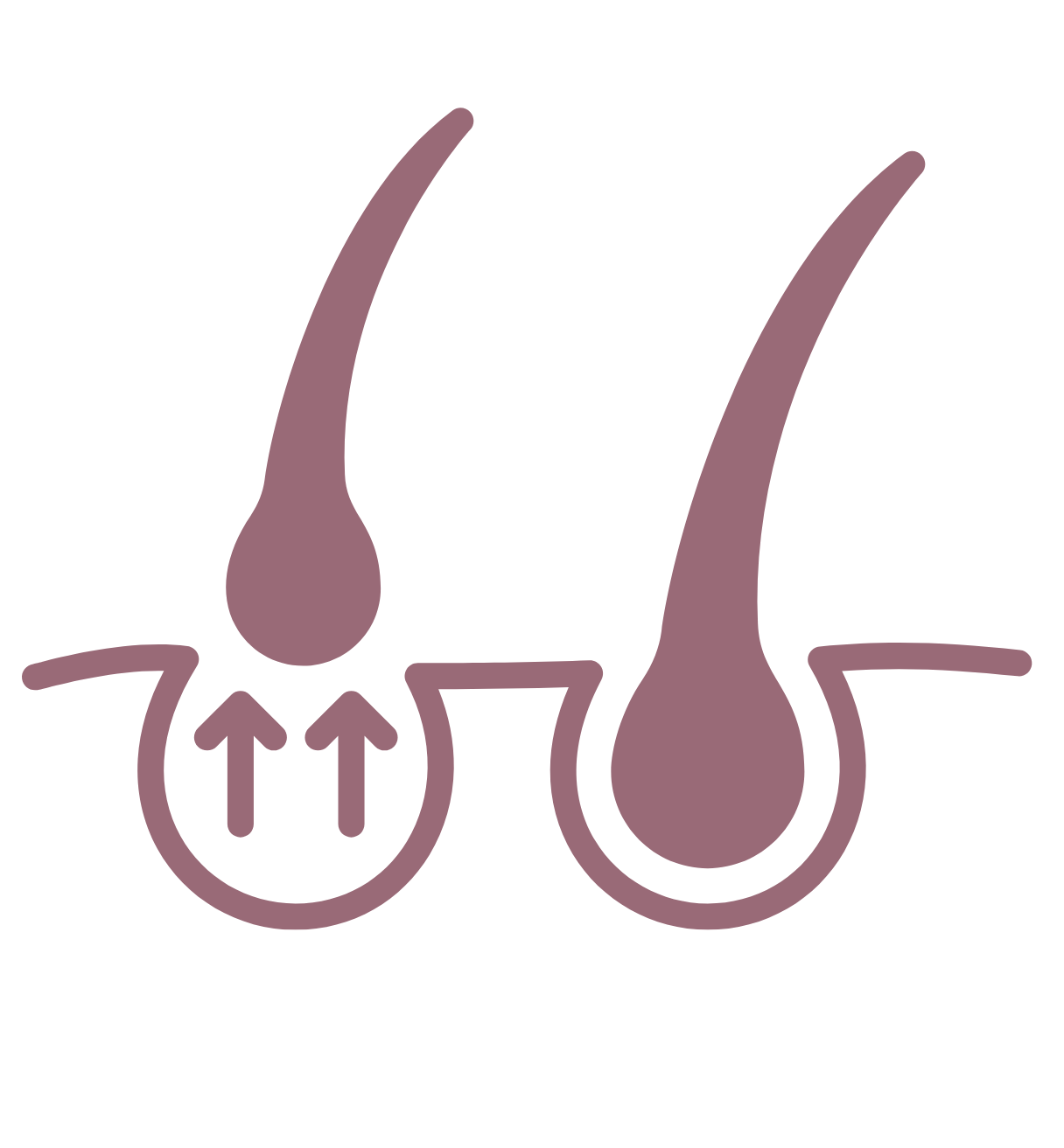 Depilación ILP (Luz Pulsada Intensa)